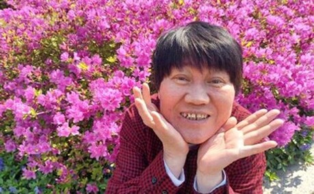 thumbimg